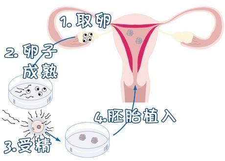 胚胎培养箱